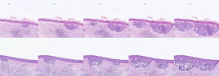 Generative AI in Pathology: Artificial Histological Skin Samples